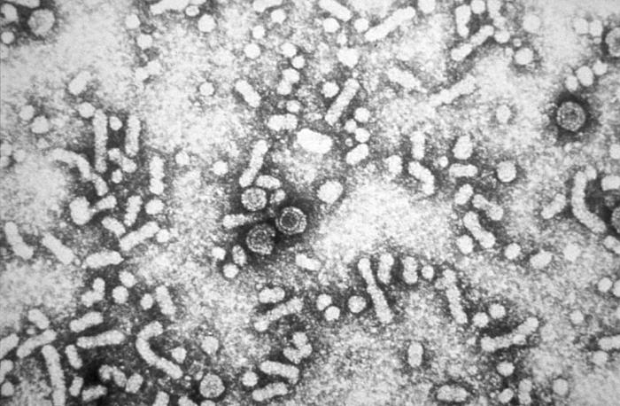 Cette micrographie électronique révèle la présence de particules du virus de l'hépatite B. © CDC, domaine public