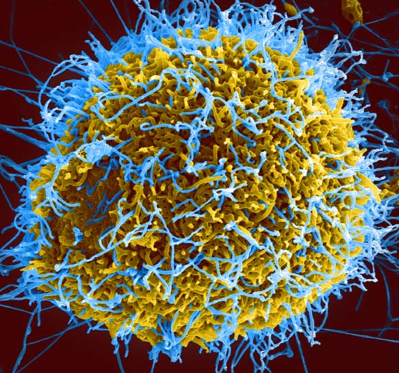 Micrographie électronique de particules de virus Ebola (filaments bleus) sur une cellule infectée. © NIAID / CC BY 2.0 